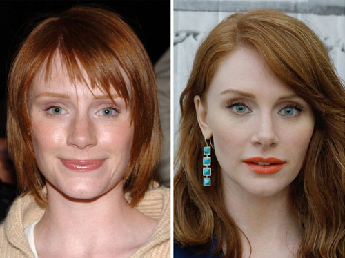 Sao Hollywood trước và sau sửa mũi, tiêm botox